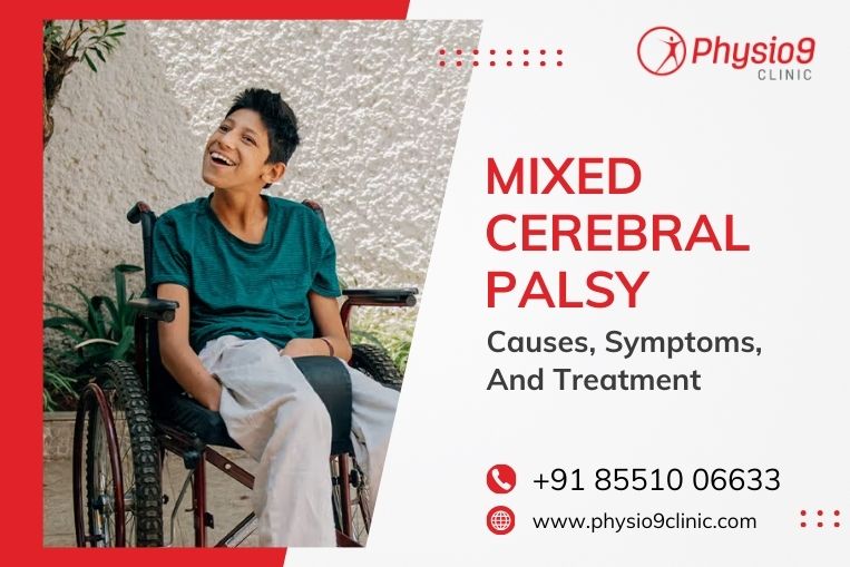 Mixed Cerebral Palsy – Causes, Symptoms, and Treatment