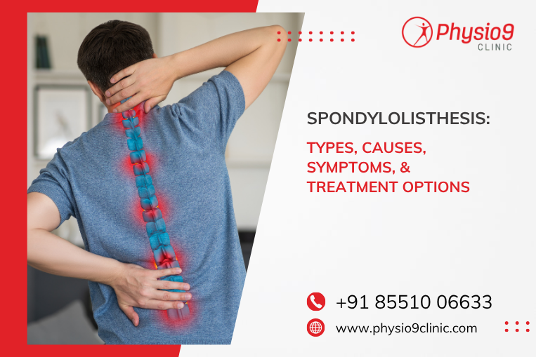 Spondylolisthesis: Types, Causes, Symptoms, and Treatment Options